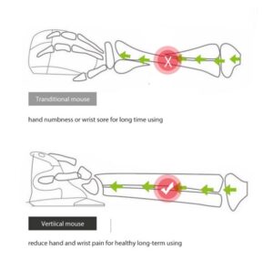 Ergonomische vertikale optische Maus - Image 4